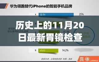 历史上的11月20日,最新胃镜检查步骤详解指南——适合初学者与进阶用户参考阅读